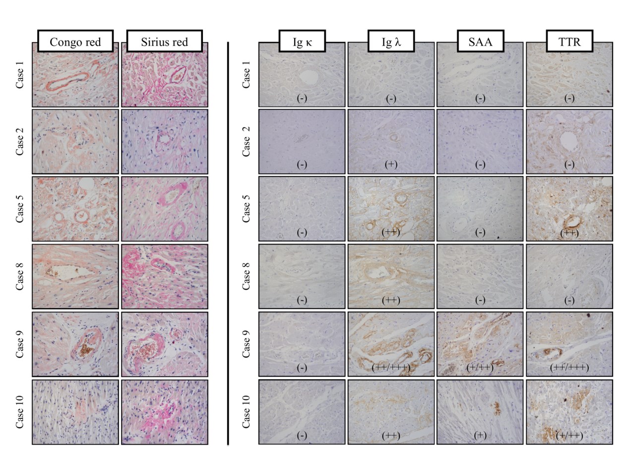 Comparison of IHC and LMD-LC-MS/MS