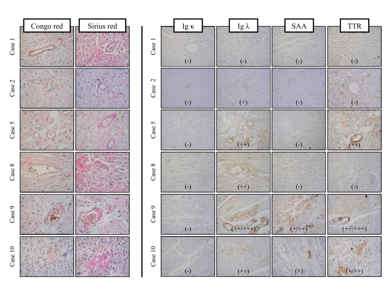 Comparison of IHC and LMD-LC-MS/MS