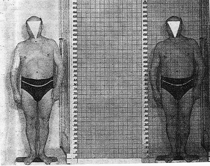 Fotogrammetrická metoda Polsko se v roce 1968 zmiňuje o fotogrammetrické metodě, která dává přehled o tvarech a rozměrech částí lidského těla.