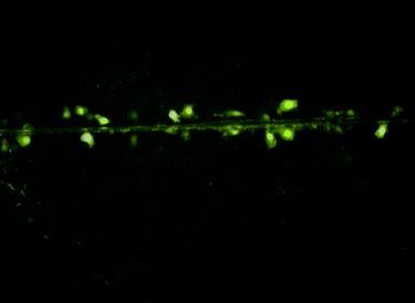 INHIBICE GJIC (scrape-loading / dye transfer assay; prostup fluoreskující luciferové