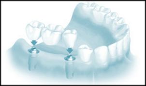 Zubní laboratoř Ceník Kontakt: Maxi DENTAL s.r.o Žerotínova 895/5a 690 02 Břeclav IČ: 29281377, DIČ : CZ29281377 č.