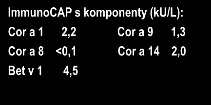 Symptomy (8 let): Těžký angioedém po musli, na pohotovosti antihistaminika a orální steroidy (bez epinefrinu) ImmunoCAP s extrakty (ku/l): Lískový ořech 3,9 Bříza 5,3 ImmunoCAP s komponenty