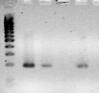Vyhodnocování diverzity AM hub v kořenech Kořeny Nested PCR s SSU rdna a ITS, klonování DNA sekvence