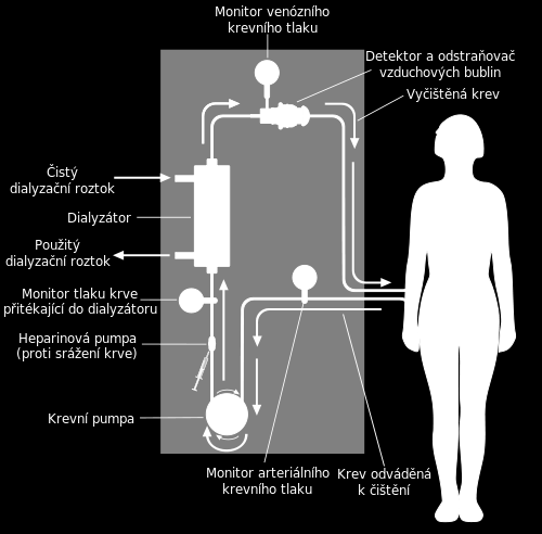 Obrázek 81. Schéma hemodialýzy (převzato z http://cs.wikipedia.org/wiki/hemodialýza). Princip elektrodialýzy podle www.mega.cz: Elektrodialýza (ED) patří do skupiny tzv.