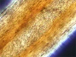 Dřeň medulla vzniká z centrálních buněk bulbu; velké pigmentované buňky nejsou keratinizované ; fragmenty