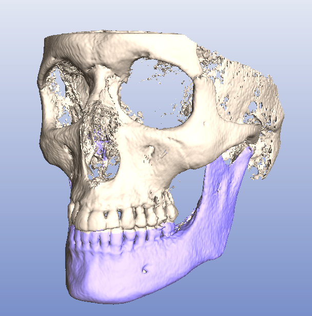 Nové produkty Planmeca přináší sofistikovaný nástroj Planmeca 4D Jaw Motion Planmeca přináší unikátní metodu sledování pohybů čelisti, která vhodně doplní širokou škálu komplexních řešení Planmeca.