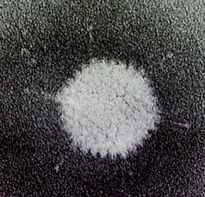 Polio Papilloma