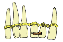 Pokud není dobrá znalost stomatologických materiálů a postupů, nemůže se obnovovat porušené žvýkací ústrojí ani se nemohou vyrábět různé zubní protézy (malé umělé korunky ani velkou celkovou protézu).