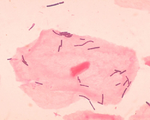 Zdravá neporušená kůže a sliznice [1] Lactobacillus