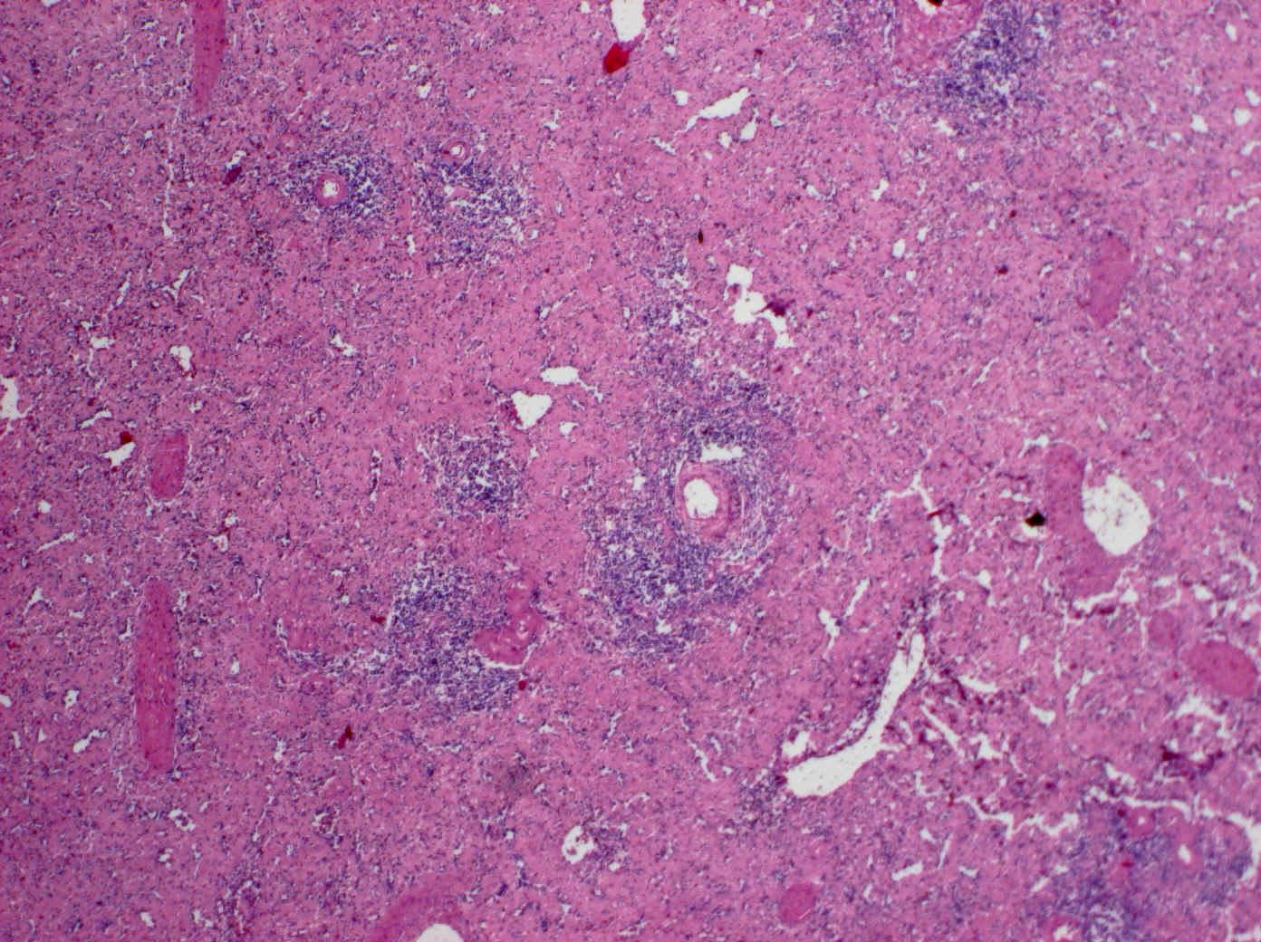 Bílá pulpa s centrální arterií Bílá pulpa (řez mimo arterii) 3 Červená pulpa prostoupená