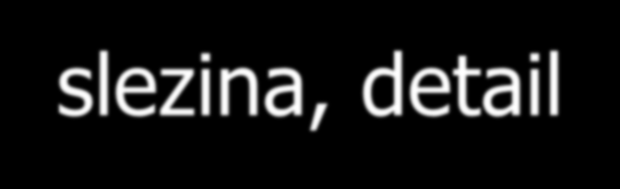 provazcích červené pulpy 9.3.