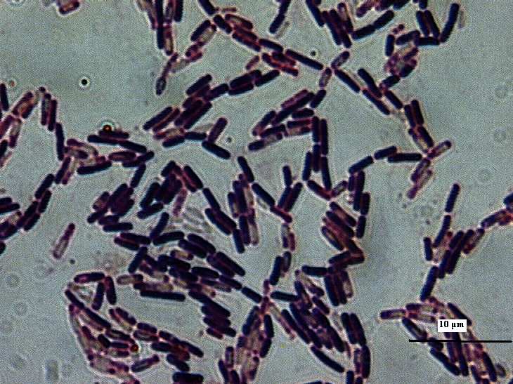 10: Ariana + nystatin, odběr 5, Obr.11: Cerason + nystatin, odběr 5, kolonie č.1, Tomato agar kolonie č.