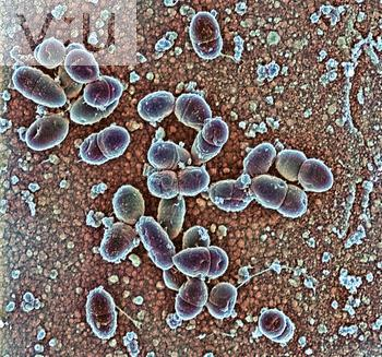 Obr. 3: Morfologie buněk Lactococcus lactis subsp. lactis [25]. 2.2.4.2 Rod Streptococcus V tomto rodu je evidováno přes 50 druhů a poddruhů.