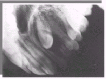 I n t r a o r á l n í s n í m k y Filmy pro intraorální zobrazení ustálené formáty speciální 27x54 mm