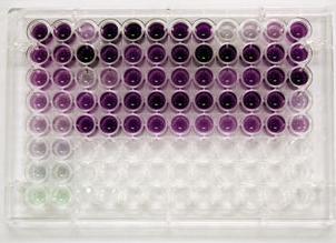 D) Stanovení koncentrace proteinů ve vzorku Spektrofotometrické metody Stanovení absorbance specifického barevného produktu Bicinchoninová