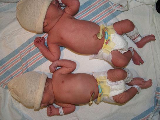 Nejčastější problémy u novorozenců hostitalitovaných na oddělení intermediární péče Problémy s krmením
