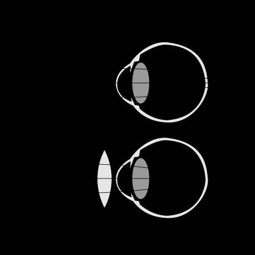 YEAR: WORKSHEET NO. 59 SUBJECT: 2. Eye Defects Physics TASK 1: Complete the table 59.