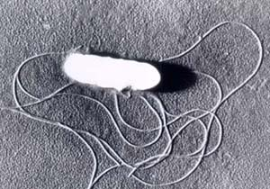 Listeria monocytogenes