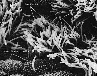 Bordetella pertussis The