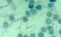 germ Borrelia