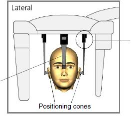 CEPHALOMETRICKÉ SNÍMKOVÁNÍ 7. Umístěte pacienta mezi dvě ušní opěrky tak, aby byl tváří k nosní opěrce. 8. Uvolněte opěrku ucha po levé ruce a velmi opatrně jí vsuňte do ušního otvoru pacienta. 9.