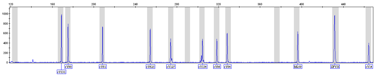 8. Výsledky a analýza (pokrač.) Obr. 1. Typický výsledek z DNA zdravého muže. Jsou přítomny všechny STS markery. Obr. 2. Typický výsledek z DNA zdravé ženy.