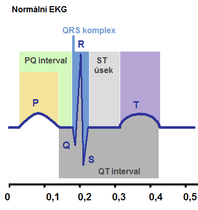 LabQuest, notebook, senzor EKG-BTA Teorie: Elektrokardiogram neboli EKG je grafický záznam elektrické aktivity srdce. Tento záznam je pořízen elektrokardiografem. Na křivce EKG rozlišujeme tzv.