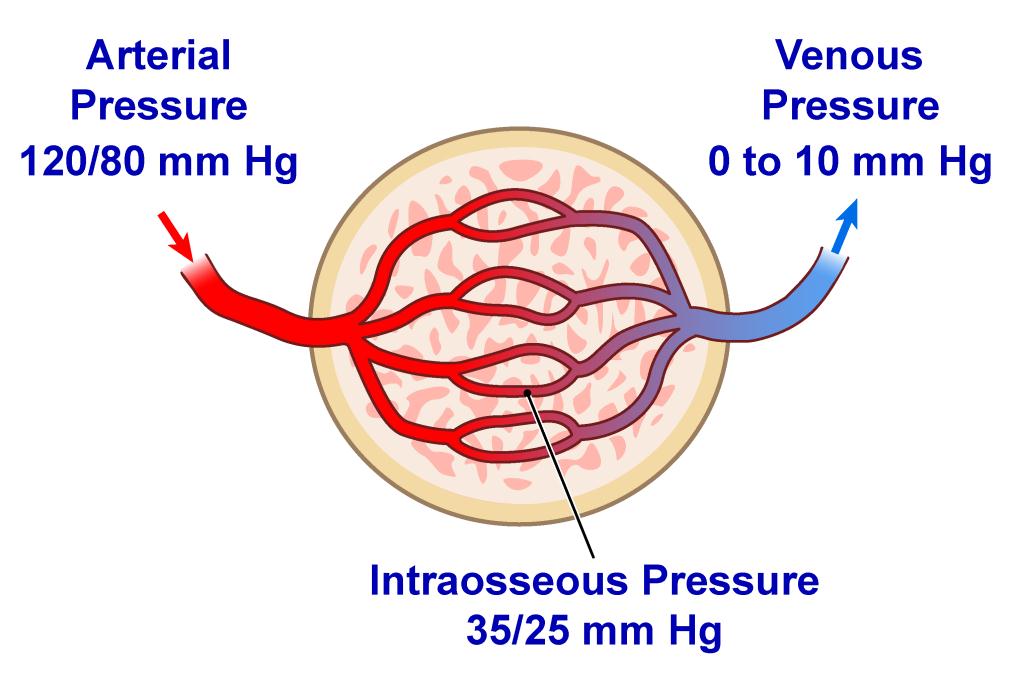Průtok IO kanylou Závisí na druhu zařízení - průtoku v jehle Anatomii pacienta Volbě místa inserce Užití přetlakového vaku 300mmHg přetlak = 5l/hod (humerus) = 1l/hod (tibie) Obecně průtok