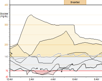 Sensor Overlay Charts and Graphs (Grafy a diagramy porovnání údajů senzoru) POZNÁMKA: Grafy a diagramy porovnání údajů senzoru se zobrazí, pouze pokud jsou k dispozici údaje senzoru.
