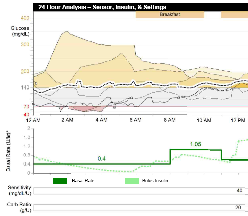 Therapy Management Dashboard (Souhrnné informace o kontrole léčby) Zpráva Therapy Management Dashboard (Souhrnné informace o kontrole léčby) obsahuje přehled regulace glykémie pacienta (denní, noční