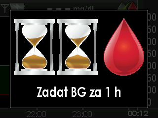 4 1. Když se zobrazí tato výzva ke kalibraci, systém vám oznamuje, že je třeba provést kalibraci pomocí jedné hodnoty glykémie. Výzvu můžete zrušit stisknutím tlačítka ZVOLIT.