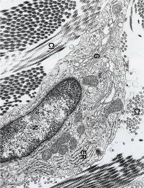 komplex, četné mitochondrie) kolagenní fibrily Mikrofotografie: