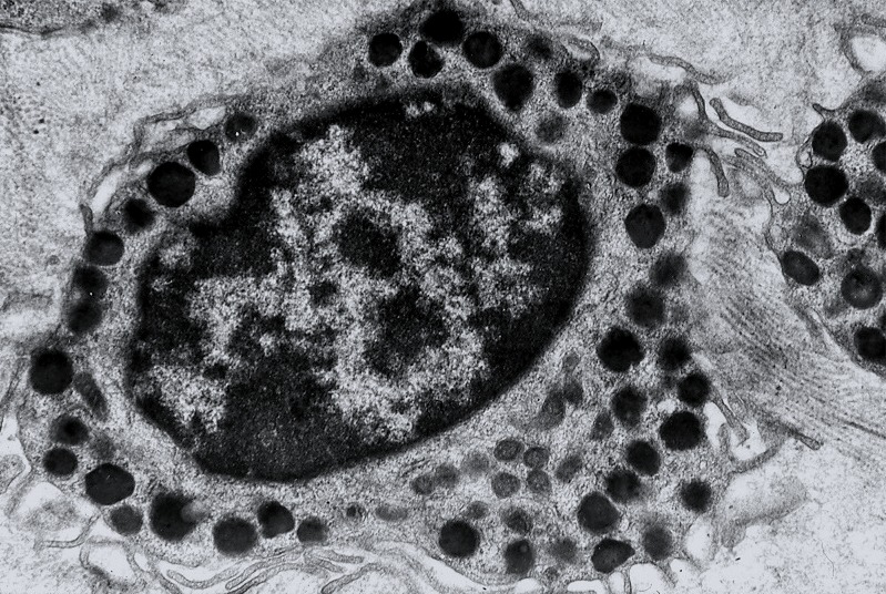 Granula - heparin, histamin, neutrální proteázy, eosinofilní chemotaktický faktor - jsou