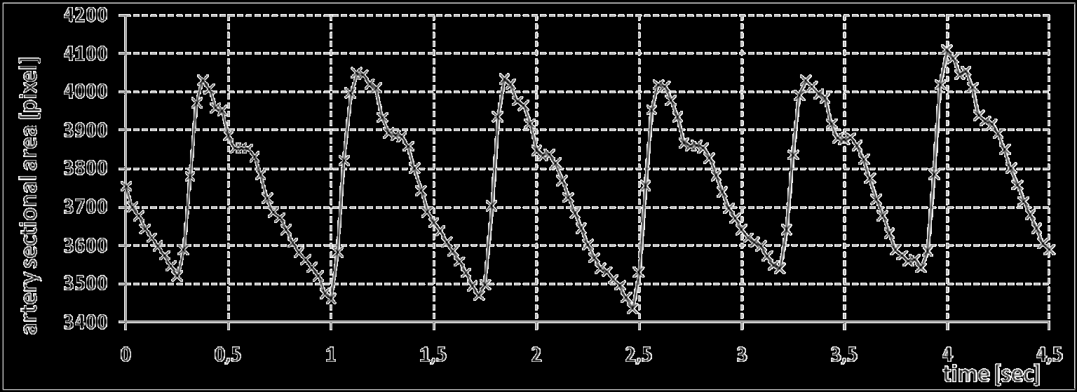 16 /18 /52 SPLAB, BUT Klepnutím experimental lze upravit results styl předlohy Final output: cardiac cycle curve the inner part of artery cross-section,