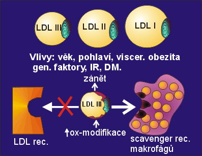 Malé denzní LDL (LDL III) nejaterogennější subpopulace LDL Aterogenní lipoproteinový