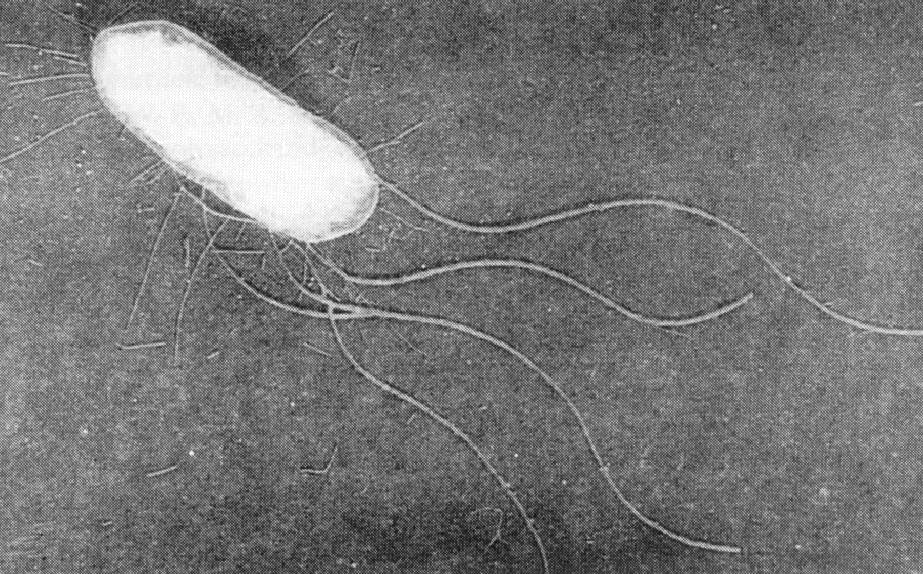 Escherichia coli objevená dr.