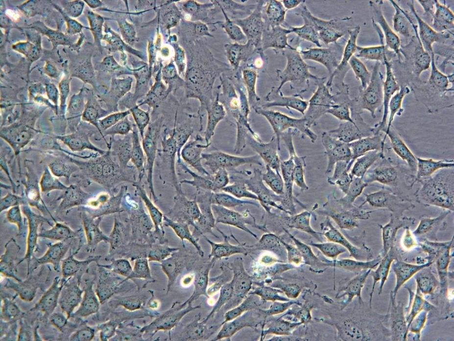 fibroblasty Buňky A549 buňky