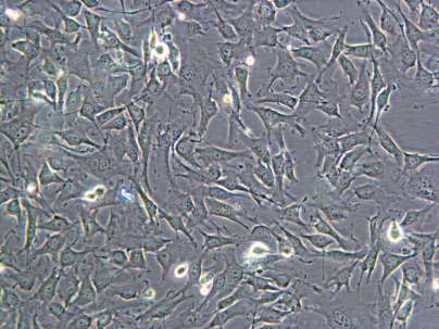Buněčné linie Buňky HEL lidské embryonální plicní