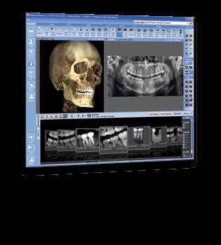 Software Planmeca Romexis pro všechny snímky Kompatibilní s Mac OS a Windows Zobrazovací software na světové úrovni Planmeca Romexis je sofistikovaný, uživatelsky příjemný software s