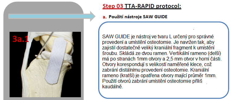 02. Operace kloubu a. Provádíte-li laterální artrotomii, nechte poslední centimetr kloubního pouzdra v blízkosti tibie otevřený. Umožní dostatek vůle k provedení advancementu. Řezání crista tibiae: 1.