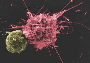 Principle of dendritic-cell based immunotherapy Leukapheresis Repetitive, long