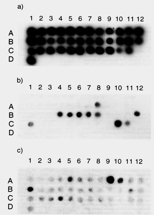 Muliplex Ligaion-dependen Probe Amplificaion (MLPA) Muliplex Ligaion-dependen Probe Amplificaion (MLPA) Muliplex Ligaion-dependen Probe Amplificaion (MLPA) Hybridizace - Souhern bloing DNA fragmen se