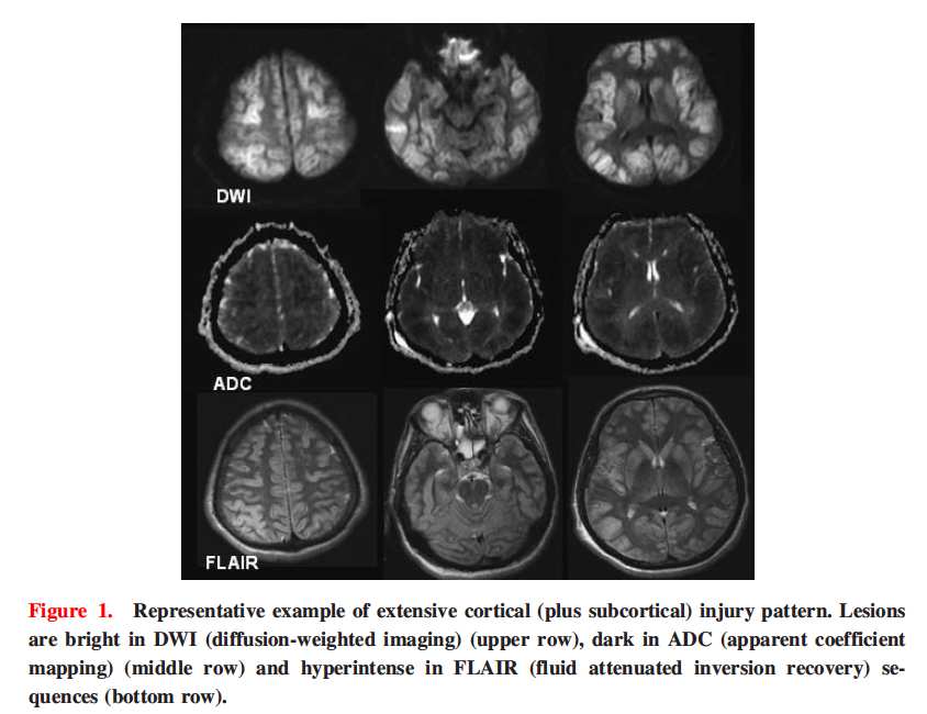 PET-CT) nemohou být vzhledem k limitujícím