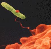 Počty bakterií rodu Legionella méně než 1 KTJ ml -1 Riziko není potřeba se znepokojovat Jak postupovat je možné postupovat podle programu běžné údržby 1 až 10 KTJ ml -1 potřeba zvýšené pozornosti