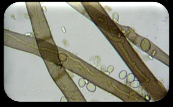 Etapy mykoparazitické aktivity Indukce klíčení (na základě gradientu metabolitů - chemotaxe) Rozpoznání hostitele (lektiny,