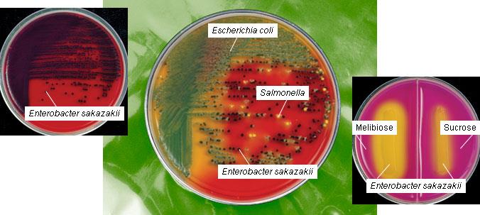 Enterobacter sakazakii detekce E.