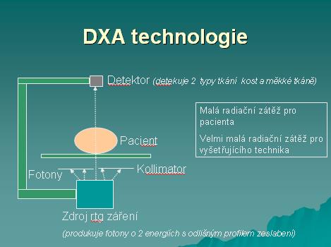 Osteodenzitometrie diagnostika osteoporosy stanovení rizika zlomeniny měření změn v průběhu času