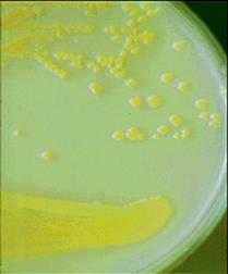 enterotoxinů produkovaných St. aureus.
