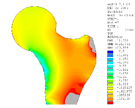 glutaeus pmax = 1,5 MPa pmax = 1,5 MPa Kontaktní tlak na chrupavce femuru (pohled shora) Kontaktní tlak na