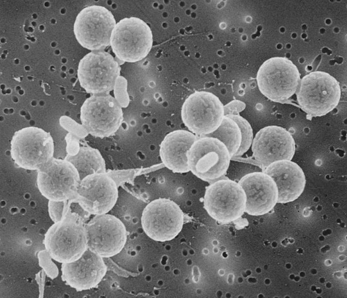 Buňky Escherichia coli O157